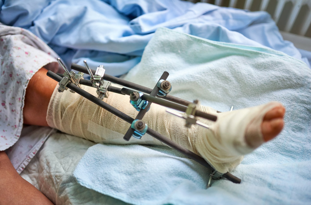 Ankle Surgery and Treatments